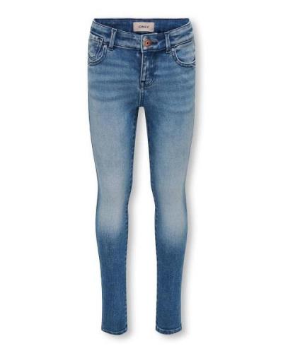 Only Jeans 15291377